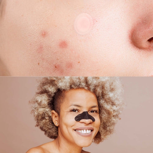 Pursonic Deep Cleansing Charcoal Nose Pore Strip 6-Pack & Hydrocolloid